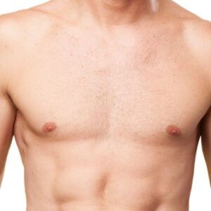 Areolas Hombres - Depilación Láser