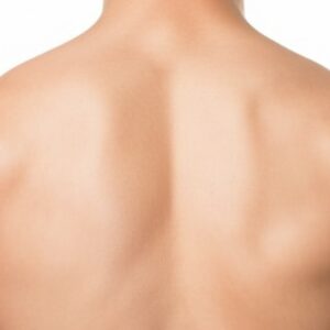 Hombros Hombres - Depilación Láser