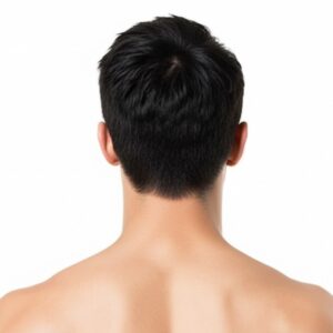 Nuca Hombres - Depilación Láser