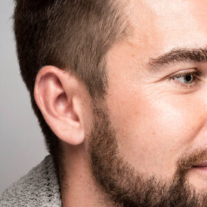 Patillas Hombres - Depilación Láser